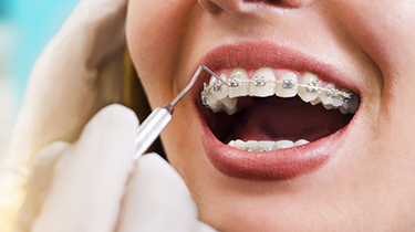 Orthodontics / Braces cover image