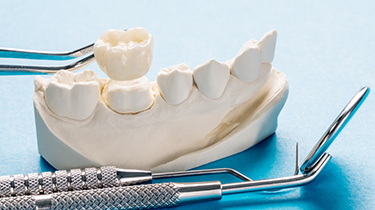 Zirconia / Ceramic cover image